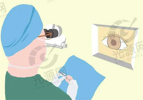私立眼科近视眼手术价格