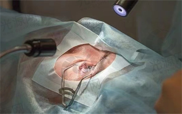 治疗近视眼手术价格收费