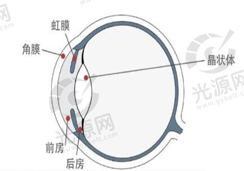 晶体植入手术有哪些风险