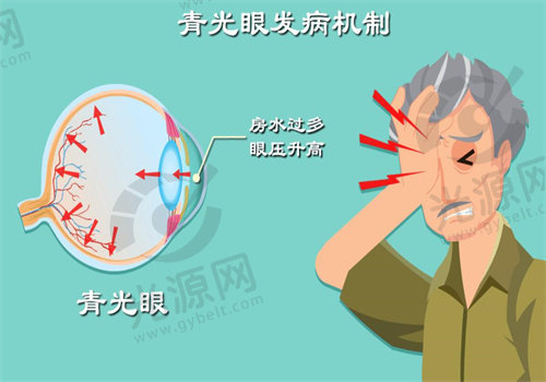 飞秒激光可以治疗青光眼吗