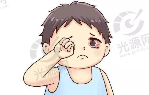 红眼病不治疗会自愈吗