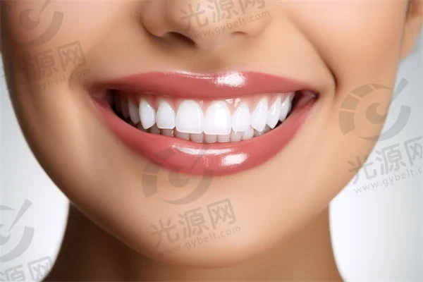 桂林牙齿美白费用是多少？2025年牙齿美白价格表详解，顺便提及四环素牙的价格情况。