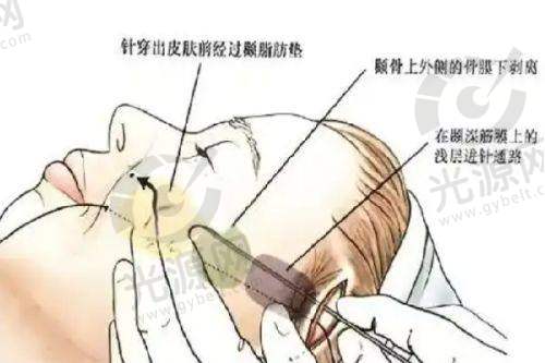 武汉卓美吴秀英靠谱吗?医生资历与口碑解析