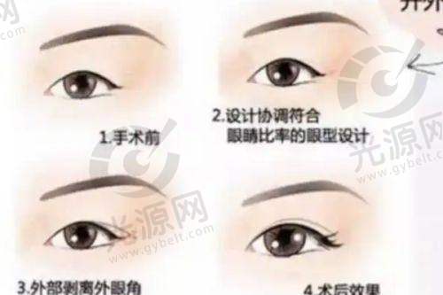 烟台地区整形项目收费情况