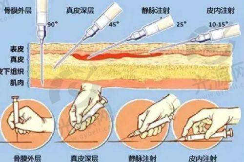 五、深圳希思医院医生预约挂号攻略