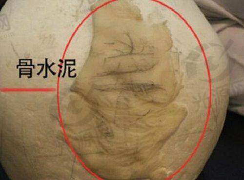 在线预约挂号快捷通道攻略