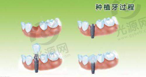 一、福州同福医口腔医院种牙怎么样，医院资质与成就
