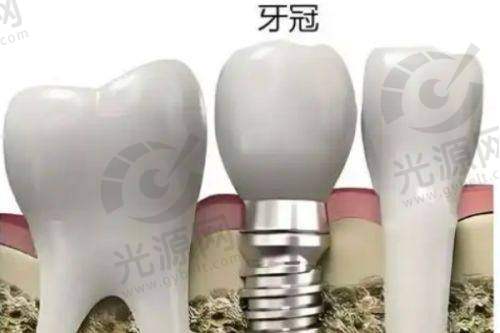 二、出色技术与表现——济南济东口腔医院的专精项目