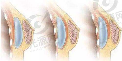 一、登封市人民医院医疗美容科,实力强大的美容医院