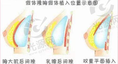 一、重庆倾心整形美容医院详细介绍