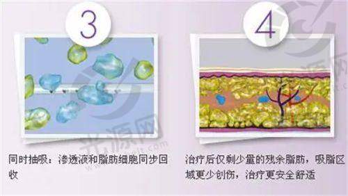 三、广州新时代整容美容医院的客户评价分享