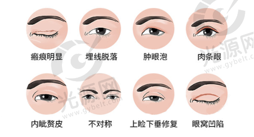 合肥马璐双眼皮实例：真实用户的赞美