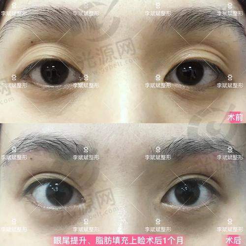 葛艳娜医生实例反馈