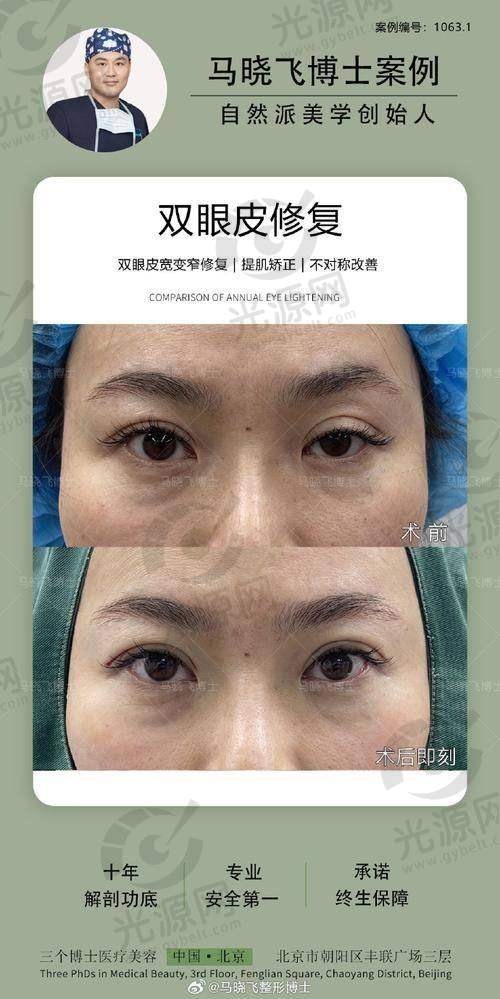 一、昆明哪里做双眼皮好的医生十大榜单