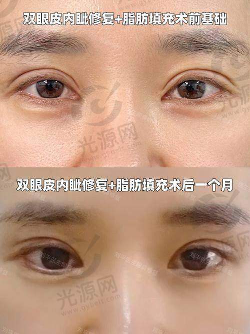 五、郑州整形医生排行榜预约挂号方式