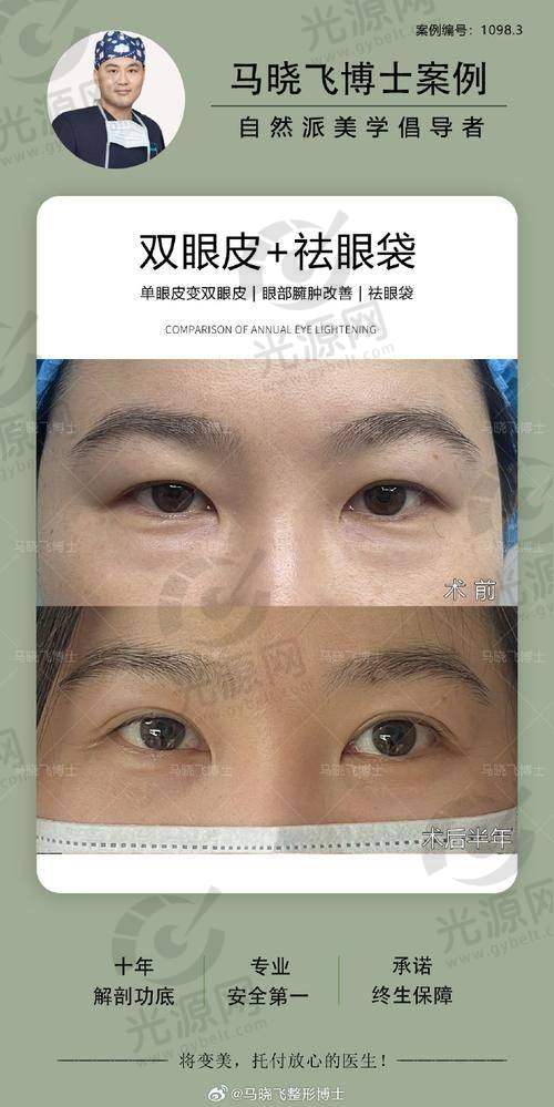 一、韩国艾源整形，详细展开介绍医院资料，资质、成就、和擅长项目等各个方面的内容