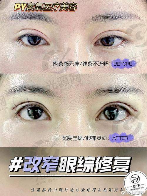 郑州整形医生排行榜排名第二：申丽医生