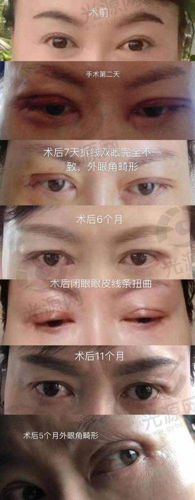 郑州整形医生排行榜排名第五：贺洁医生