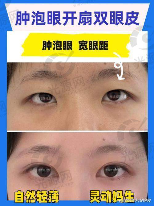 郑州整形医生排行榜排名第十：杨丽医生