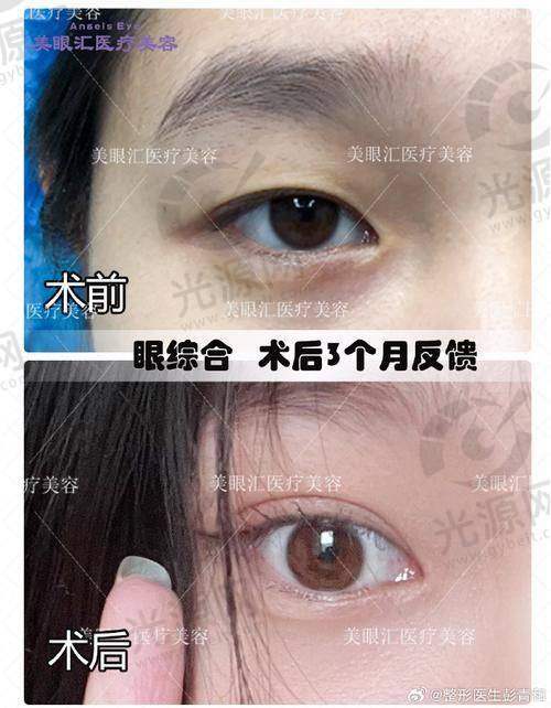 三、昆明韩辰医疗美容医院的客户口碑和实例评价