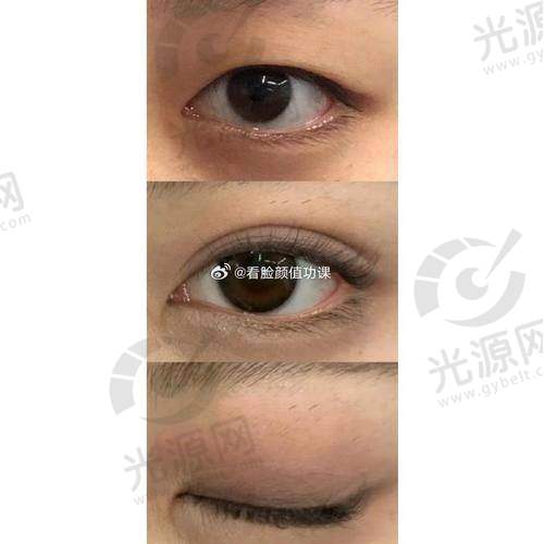 郑州整形医生排行榜排名第八：邵志明医生
