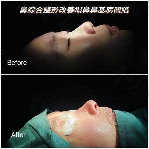 李东霖整形医生：专注面部精雕与个性化美学方案，助您实现理想美丽目标