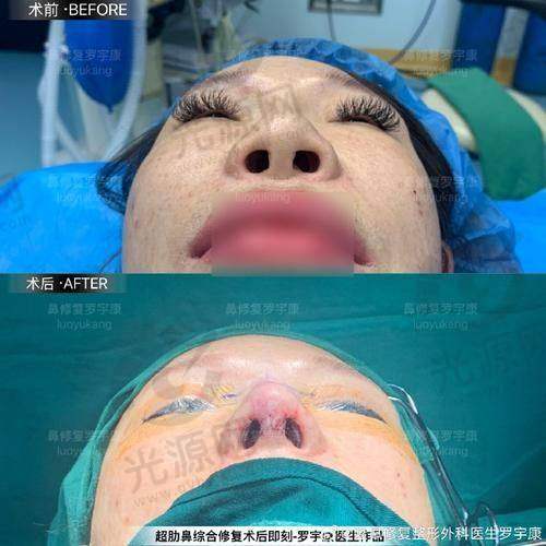 五、深圳整鼻子比较有名的医生预约挂号方式