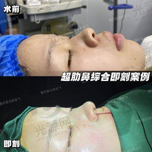 李东霖医生的真实实例分享