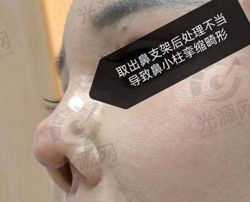 五、北京做鼻子好的医生排名预约挂号方式
