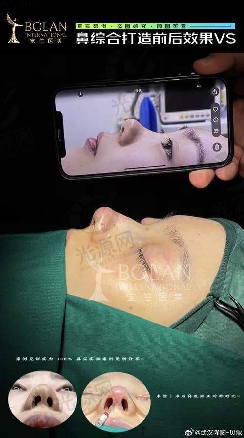 李东霖医生的技术特长与优势