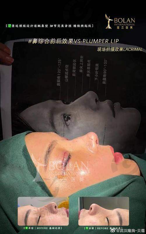 福州做鼻子出名的医生价格表