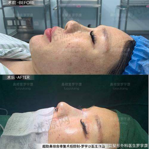 北京做鼻子好的医生排名第五：薛轶群医生