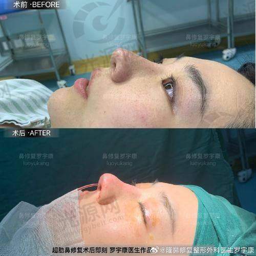 福州做鼻子出名的医生排名第三：黄振银医生