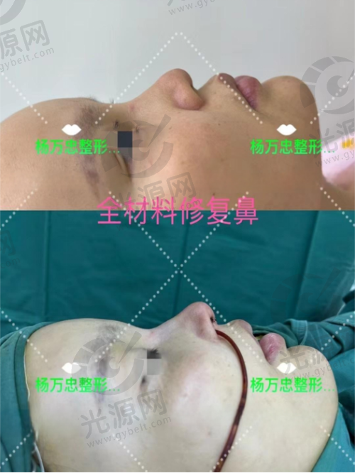 福州做鼻子出名的医生排名揭秘，前十位技术超群的隆鼻医生推荐