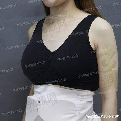 傲若拉假体价格多少钱的市场概况