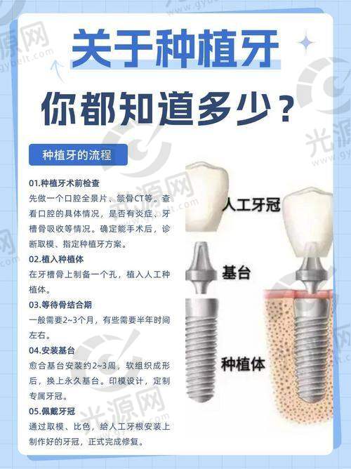 4. 牡丹江医学校附属医院口腔科 - 大型医院背景，技术与服务并重