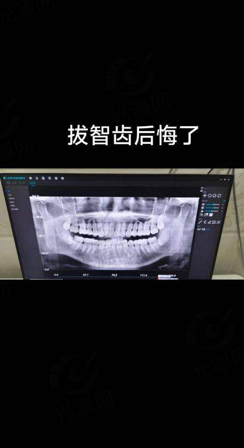 横生智齿医生建议信息的可信性