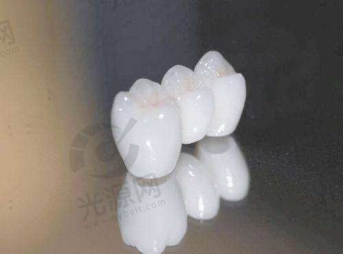 铂晶瓷全瓷牙的基本介绍