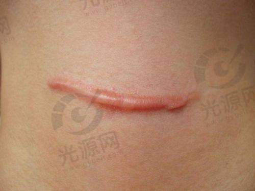 用户真实评价：董雷医生的口碑如何？