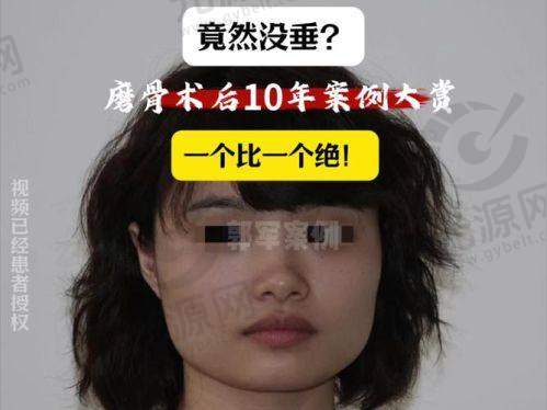 如何预约金一秀医生的磨骨手术？