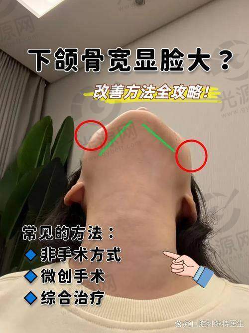 金一秀磨骨多少钱？患者真实实例分享