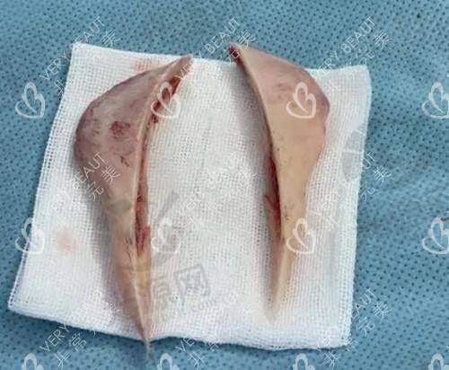 总结：金一秀磨骨价格多少，值得投资吗？