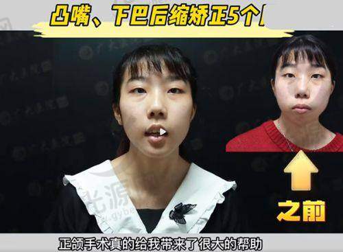 唐毕医生的技术优势