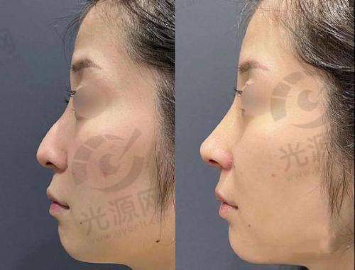 君熠医疗美容正规性分析：东莞君熠医疗美容是否值得信赖，安全与技术保障详解