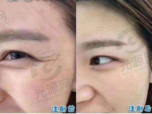 三、医院口碑如何?不妨来看集美们的实例评价