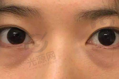来自求美者的真实反馈