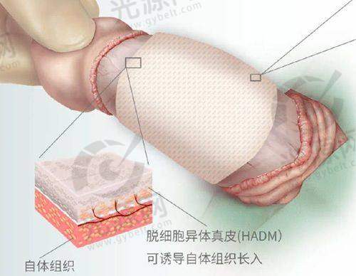 李冰冰医生的微整形技术