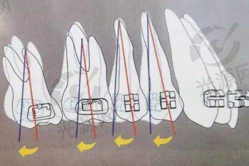 淮安牙科医生做矫正排名第2：李医生