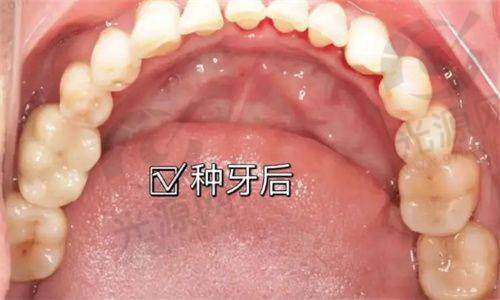 三、尤旦口腔医院口碑评价