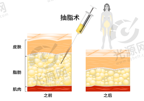 重庆丽源整形医院简介及地址曝光，专业整形美容服务受邀评价98%好评，助您轻松实现美丽梦想